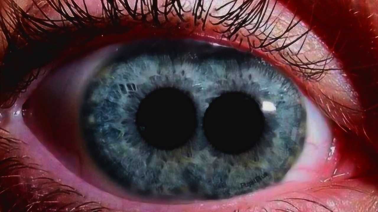拥有双瞳孔到底是好是坏他们眼中的世界是什么样的