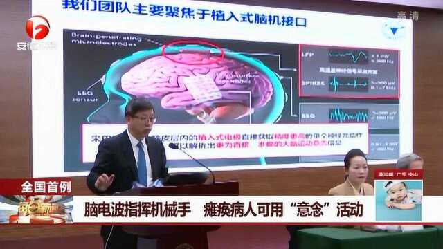 高科技!脑电波指挥机械手 瘫痪病人可用“意念”活动