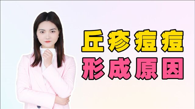 丘疹型痘痘是怎么形成的呢,是呈什么样的形态?