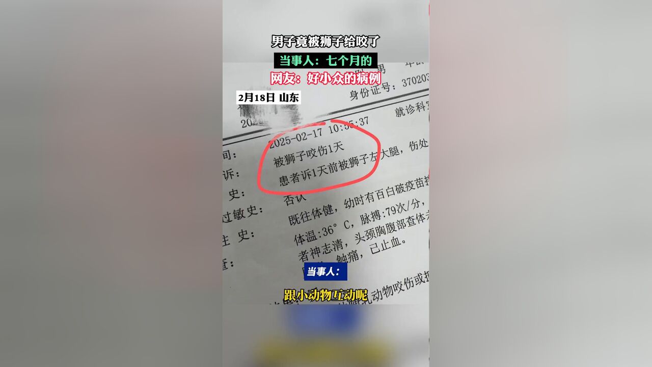 男子竟被狮子给咬了 当事人:七个月的 网友:好小众的病例