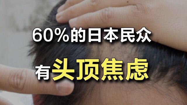 60%的日本民众有头顶焦虑!假发行业异常火爆