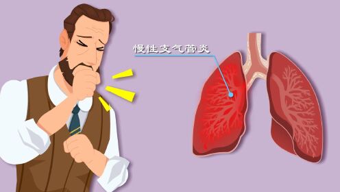 支气管为啥发炎？不停咳嗽背后真相是啥？慢支发病机制动漫版！