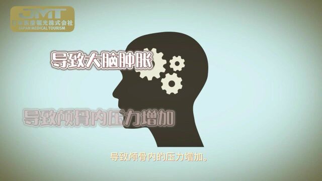 JMT日本医疗签证不同类型的脑肿瘤症状——日本医疗观光株式会社