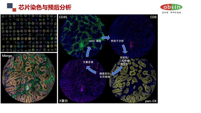 多重荧光免疫组化技术 mIHC技术 