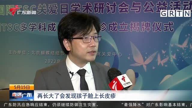 全国首个结节性硬化症多学科成人综合门诊在广州成立