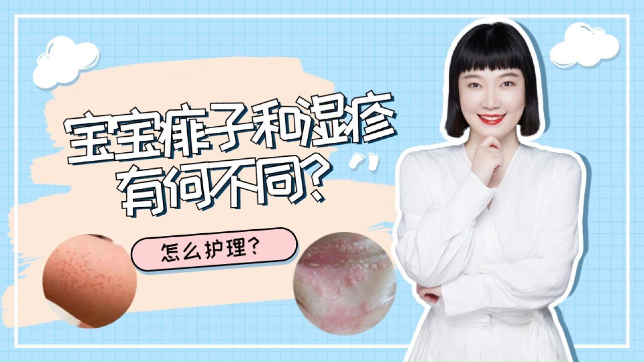 痱子和湿疹如何区分?怎么护理?简单省钱的好办法教你缓解