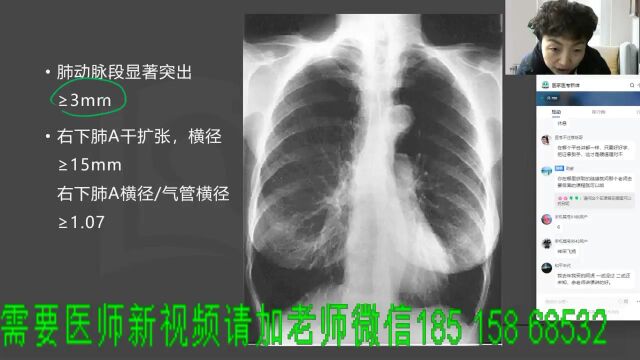 2023年临床执业医师临床助理医师呼吸系统23——薇薇老师