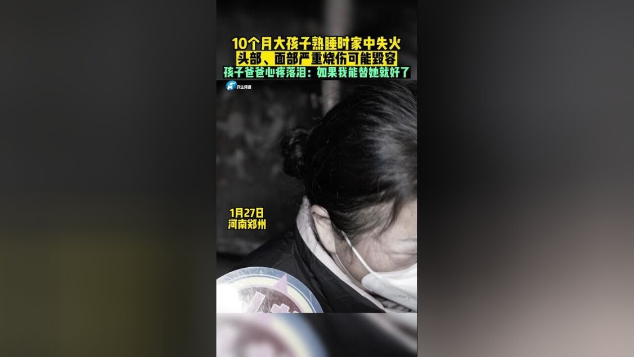 河南省郑州市,家中失火10个月宝宝被烧伤