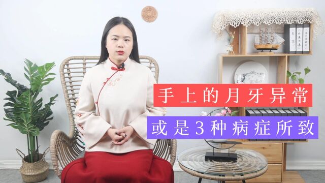 指甲上的月牙是什么?其结构异常和什么有关?这3点不妨一看