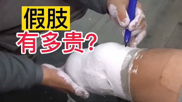 装假肢,有多贵?