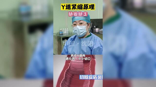 「女性健康」荫道紧缩原理:随做随走!