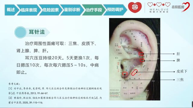 面瘫科普小知识