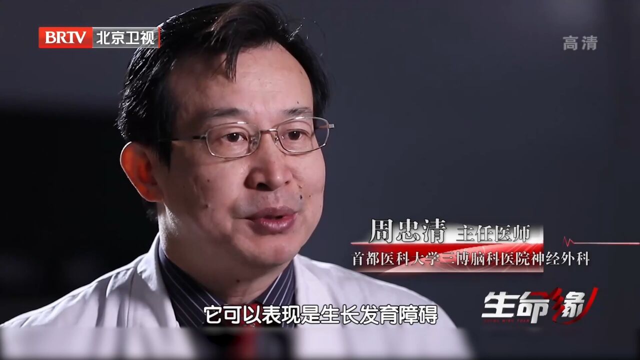 双胞胎一直有着身高差距,相差最大18厘米,令人惊叹