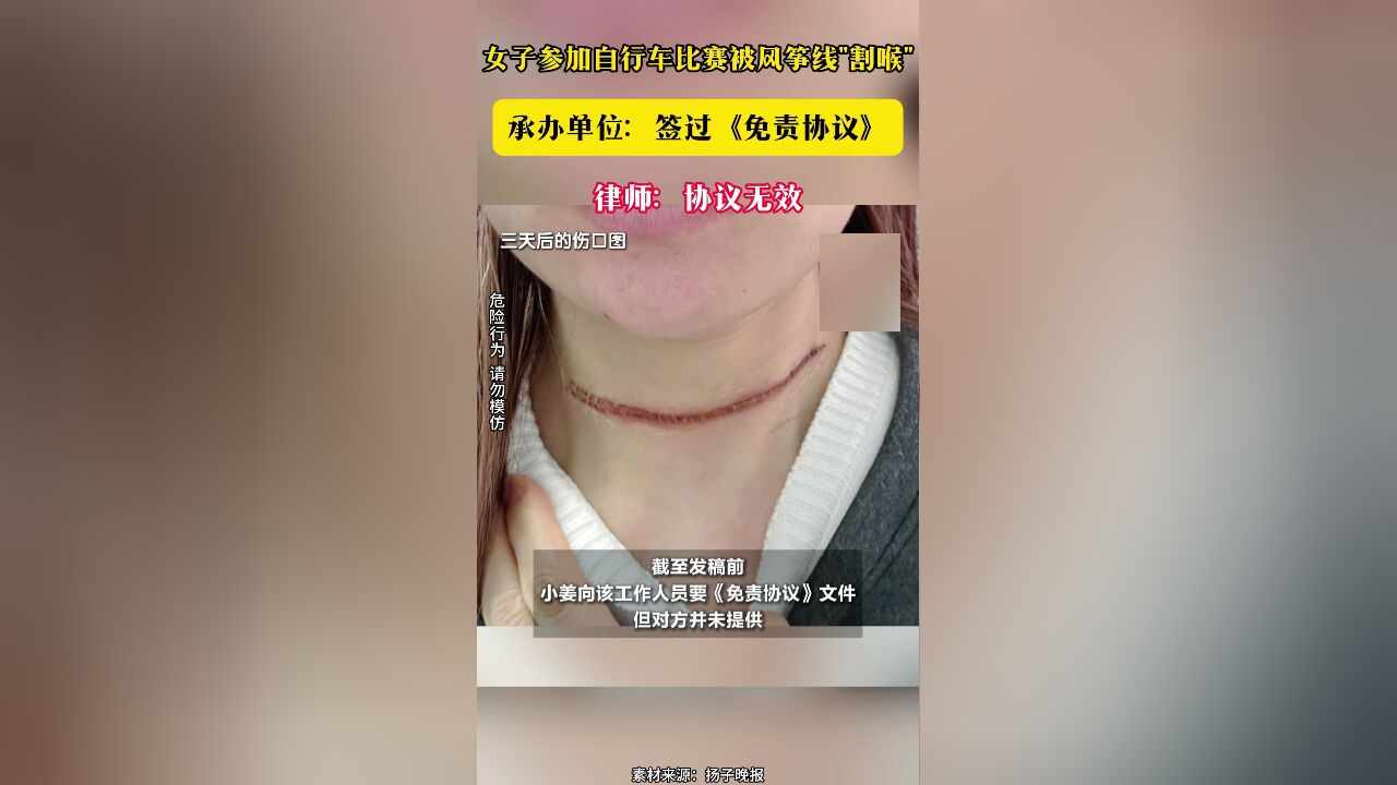 女子参加自行车比赛被风筝线割喉承办单位:签过《免责协议》 律师:协议无效