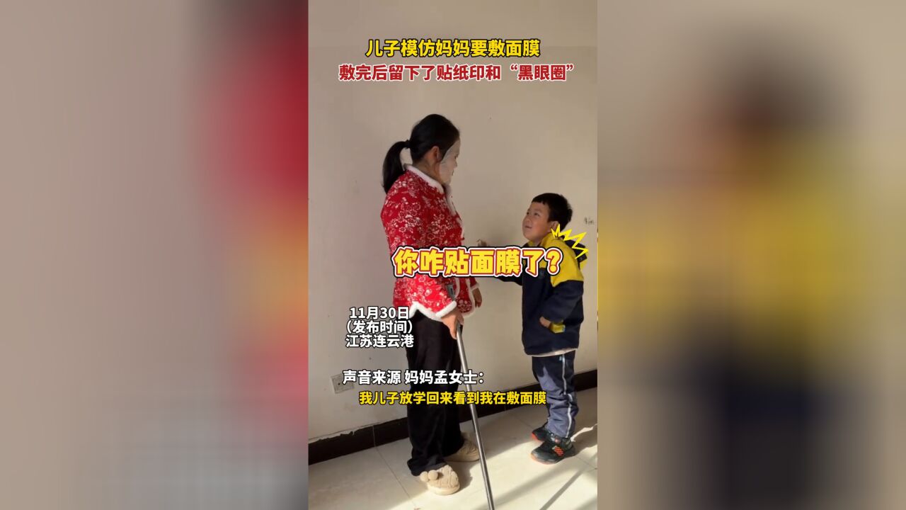 儿子模仿妈妈要敷面膜,敷完后脸上留下了贴纸印和＂黑眼圈＂