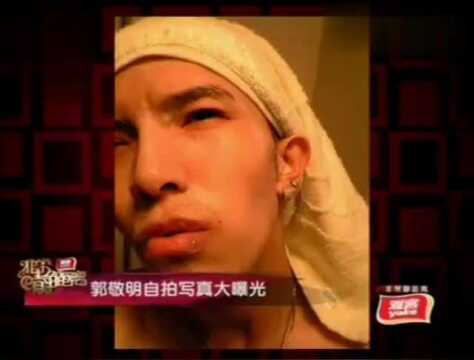 非常静距离:郭敬明的博客点击率很高,自拍写真大曝光