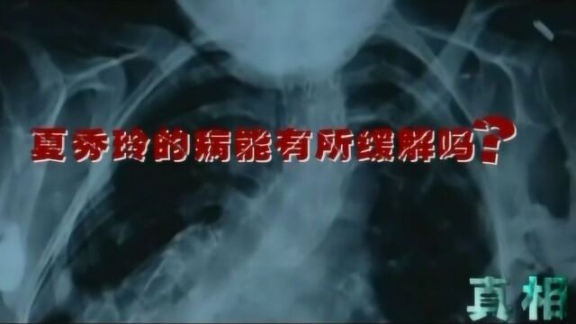 真相:女子身患怪病,医生看见X光片震惊了,肌肉里长满骨头