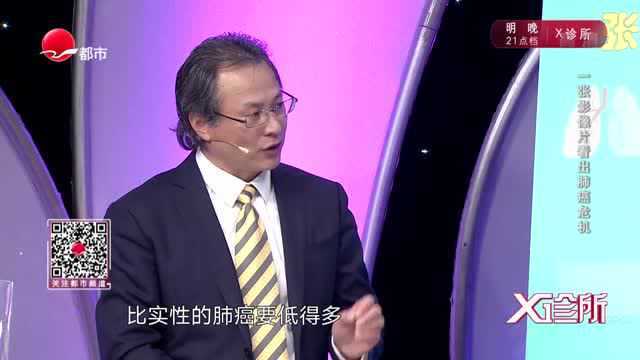 磨玻璃结节的危险程度究竟是多少呢?听听专科医生的建议