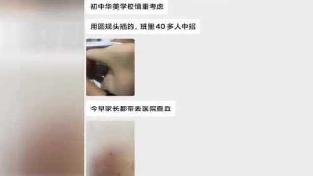 揭阳教师用圆规扎未完成作业学生 官方:涉事教师已被抓