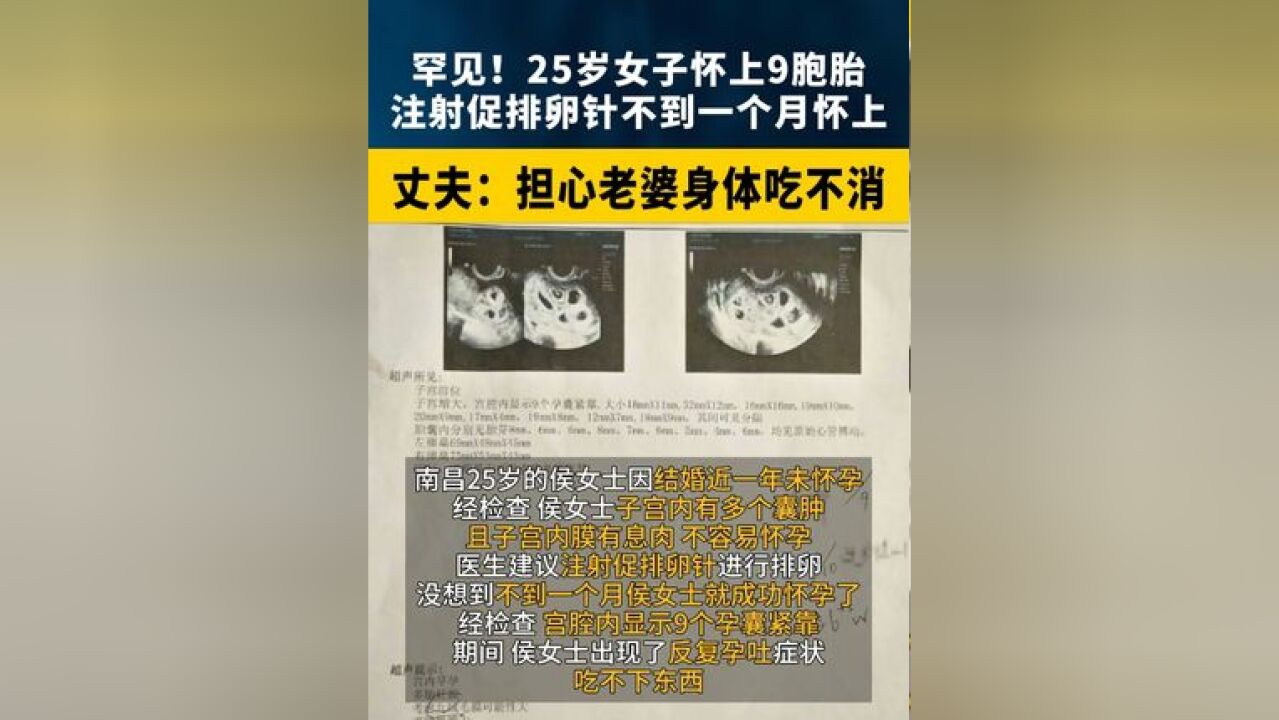 罕见!25岁女子怀上9胞胎!注射促排卵针不到一个月怀上.丈夫:担心老婆身体吃不消