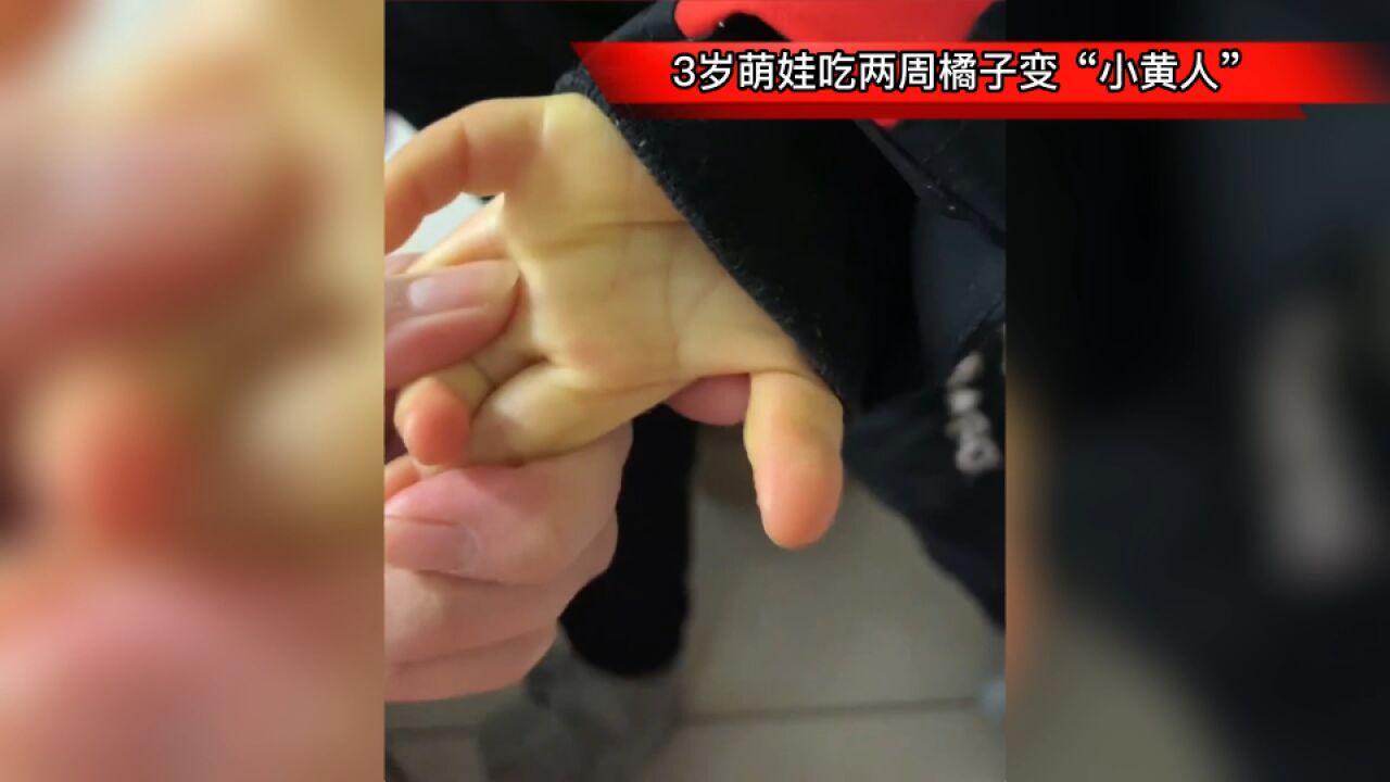 3岁萌娃吃两周橘子变“小黄人”,妈妈:不让吃了,严重会就医