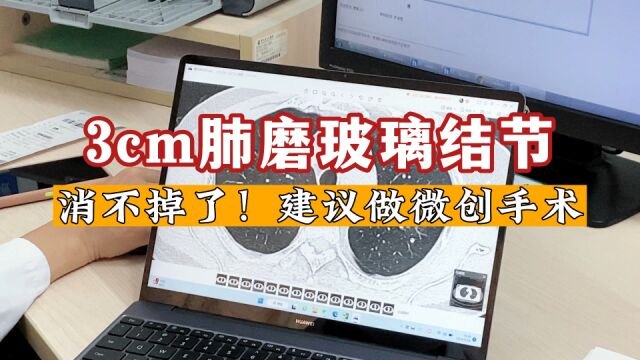 3cm肺磨玻璃结节,预计近2年会进展?建议做微创手术切除