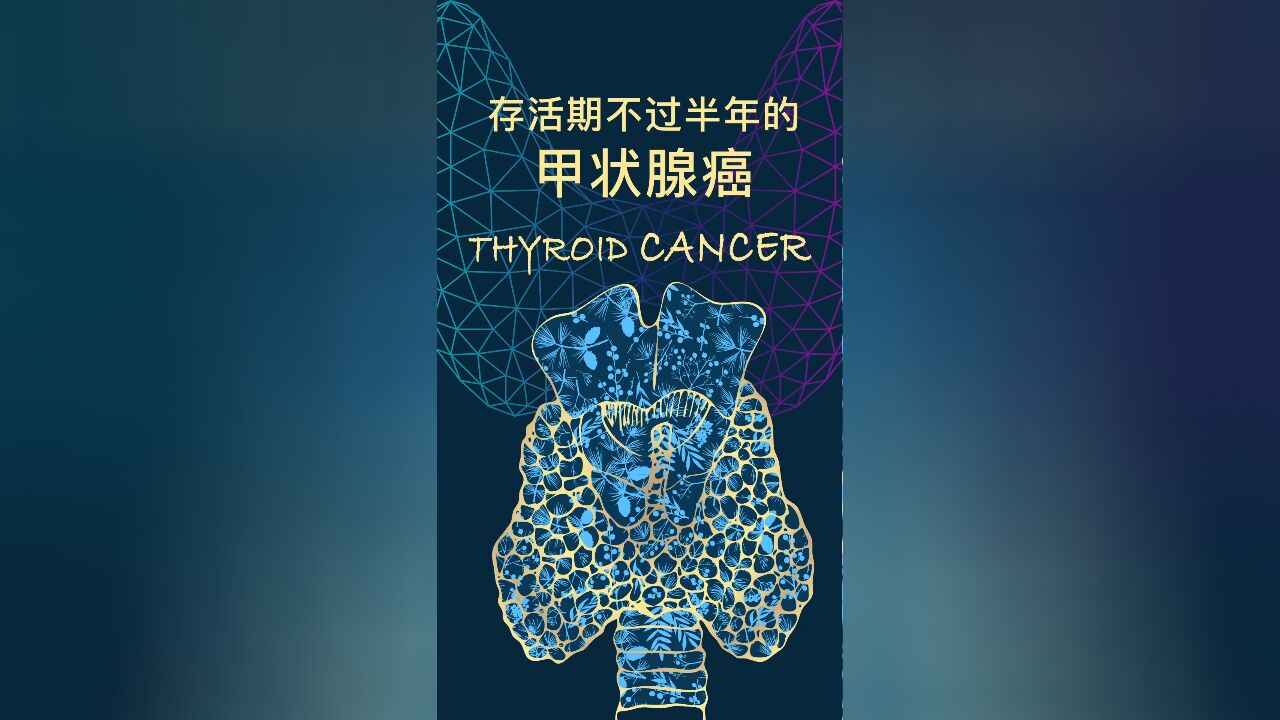 未分化型甲状腺癌,癌界霸王花