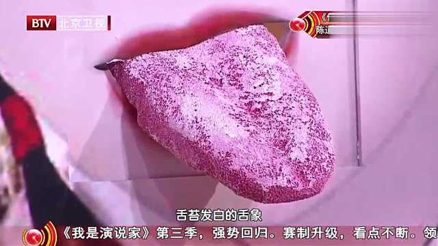 哪种舌型预示着肺癌的体质?我是大医生教您看清舌头!