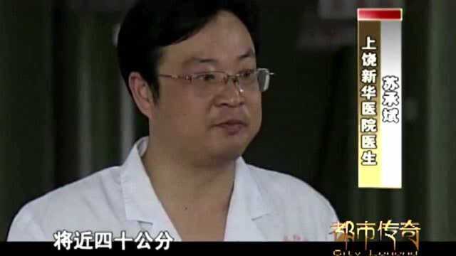 35岁单身汉多次自残轻生,用刀片划伤肚子,家人却说:真丢脸!