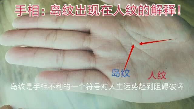 手相符号:岛字纹的解释(47)