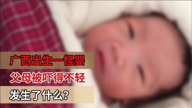 广西出生一怪婴,父母被吓得不轻专家直呼罕见,发生了什么?