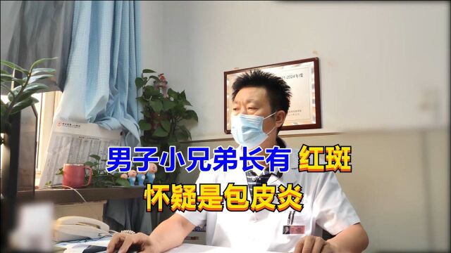 男子小兄弟长有红斑,怀疑是传染病上身,泌尿专家:只是感染而已!