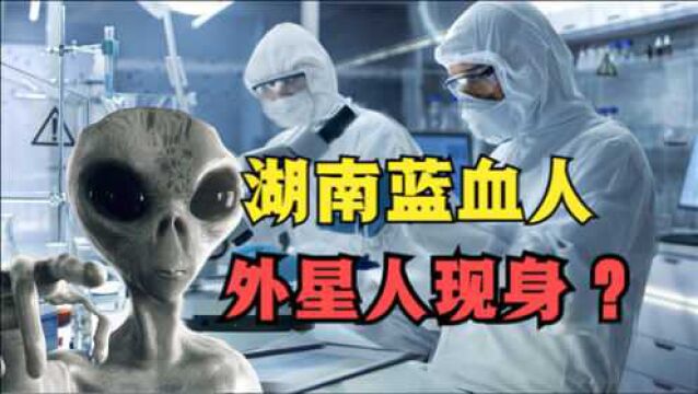 湖南惊现“外星女人”?留着蓝色血被送进医院,难道真有外星人?