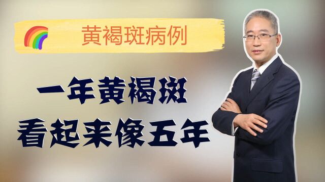 一年的黄褐斑看起来却像五年黄褐斑,原因竟是这!