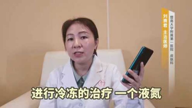 脚底长疣体怎么办?学会这几招,不再是困扰