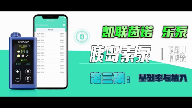 凯联茵诺乐泵胰岛素泵使用体验之基础率设置与植入 
