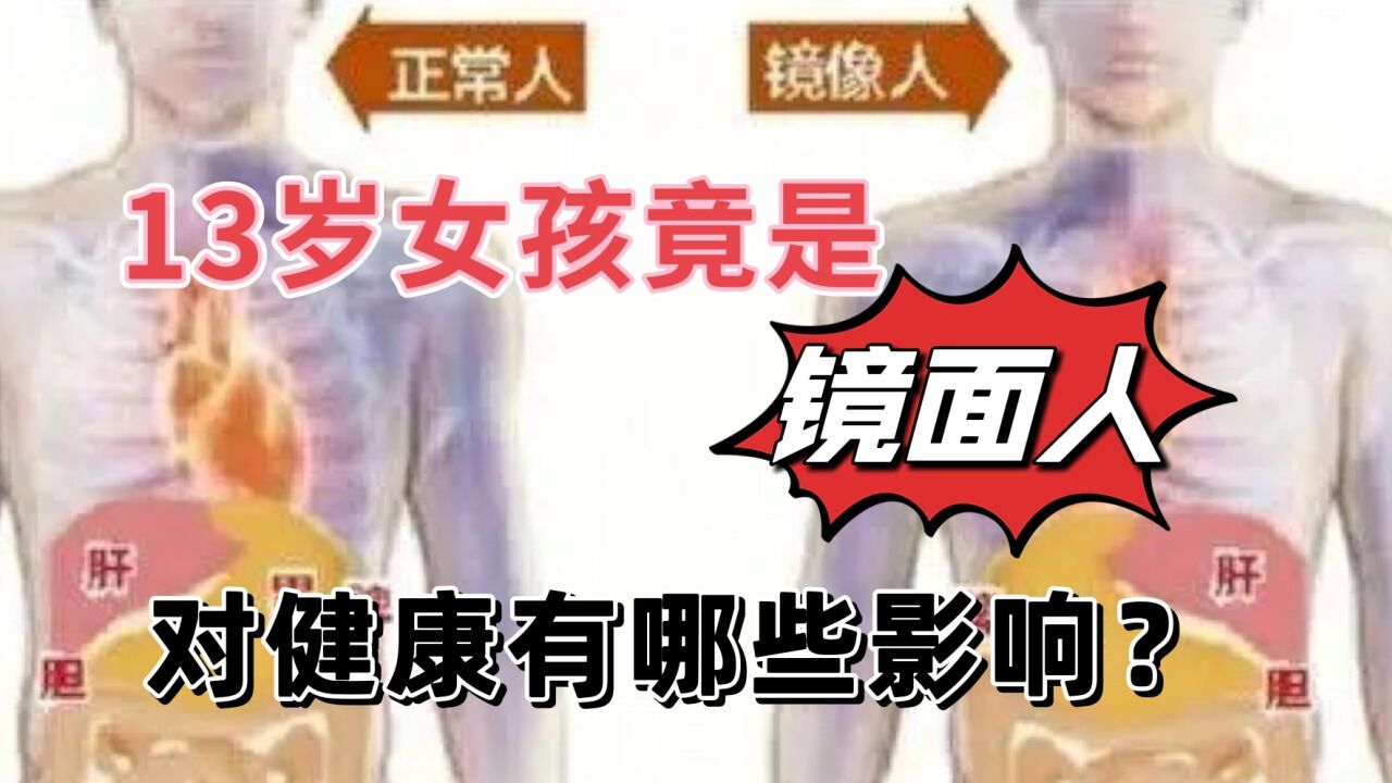 福建13岁女孩竟是罕见的“镜面人”!内脏全反位,对健康有影响吗?