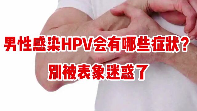 男性感染HPV,会有哪些症状?别被表象迷惑了