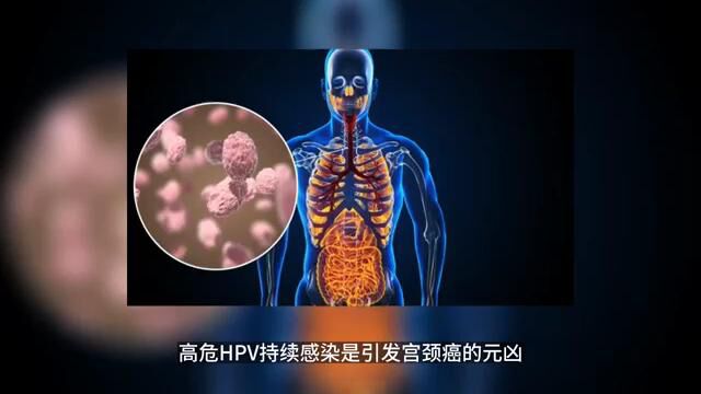 妇科炎症与HPV感染的关系 南京华肤医院