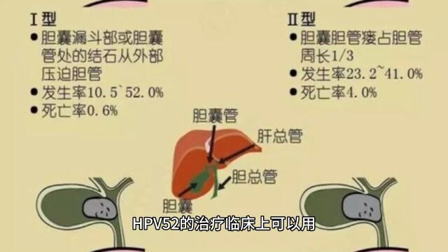 hpv52怎么治疗才转阴南京家和医院