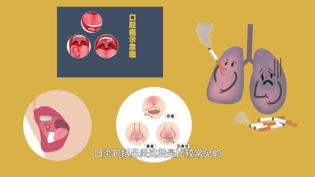 心血管疾病、患癌风险、口腔疾病……点燃的烟草到底多可怕