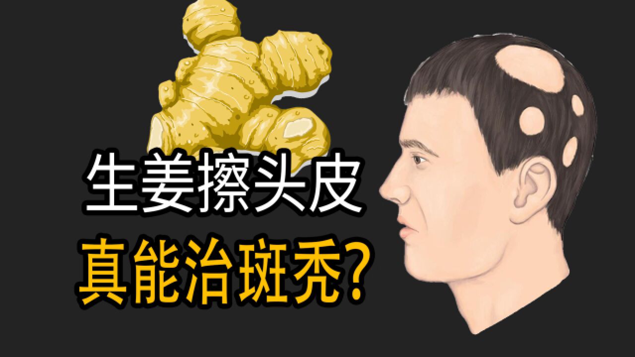 生姜擦头皮,真能治斑秃吗?