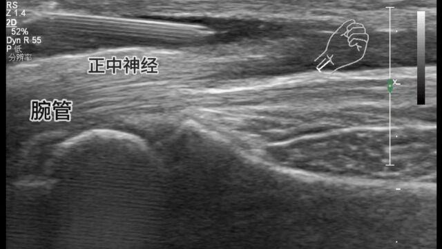 成华三医康复肌骨超声