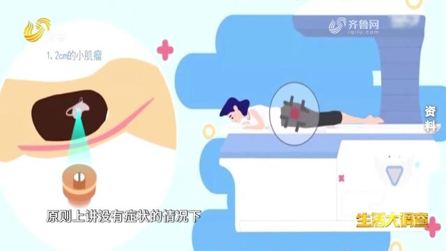 患上子宫肌瘤需要立即做手术吗?医生现场分析划重点,来看看