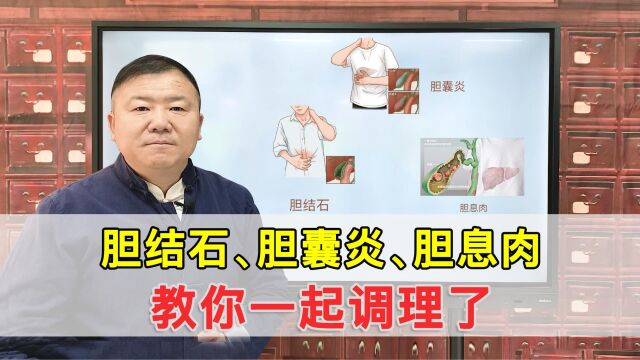 胆结石没管,出现胆囊炎、胆息肉,三者同时存在,教你一起解决