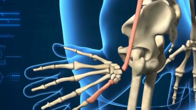 3岁男孩天生手部畸形,矫正手术难度巨大,医生万分谨慎