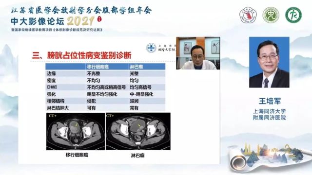 膀胱占位性病变诊断及鉴别诊断同济大学附属同济医院王培军