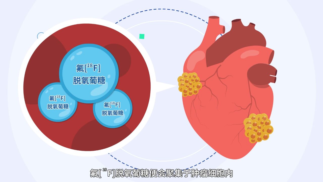 【小核同学科普秀】“核技术”也能守护健康?“核医疗”篇(二)