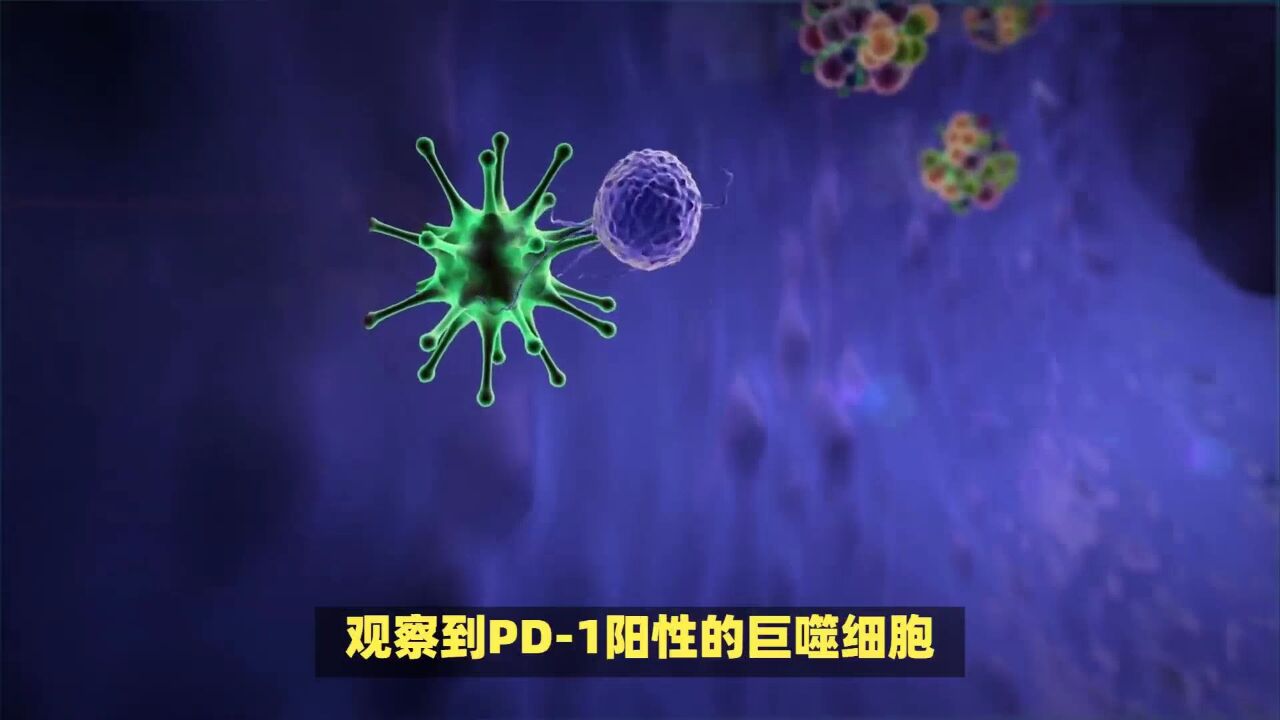 《自然》重磅研究:肥胖可能提升癌症免疫疗法效果