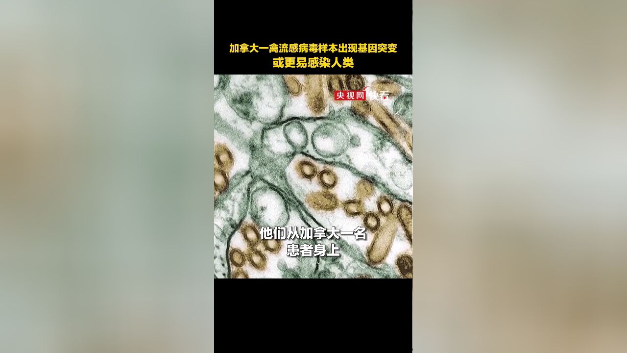 美媒:加拿大一禽流感病毒样本出现基因突变,或更易感染人类